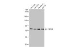 ACSL4/FACL4 Antibody in Western Blot (WB)