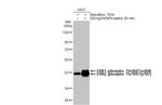 Phospho-ERK1/ERK2 (Thr202, Tyr204, Thr185, Tyr187) Antibody in Western Blot (WB)