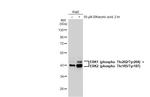 Phospho-ERK1/ERK2 (Thr202, Tyr204, Thr185, Tyr187) Antibody in Western Blot (WB)