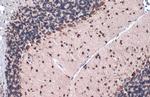 Gli1 Antibody in Immunohistochemistry (Paraffin) (IHC (P))