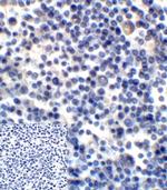 CD276 (B7-H3) Antibody in Immunohistochemistry (Paraffin) (IHC (P))