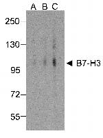 CD276 (B7-H3) Antibody in Western Blot (WB)