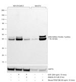 Phospho-ERK1/ERK2 (Thr202, Tyr204) Antibody in Western Blot (WB)