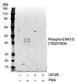 Phospho-ERK1/ERK2 (Thr202, Tyr204) Antibody in Western Blot (WB)