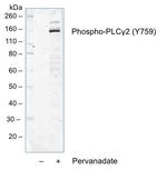 Phospho-PLCg2 (Tyr759) Antibody in Western Blot (WB)