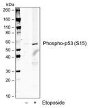 Phospho-p53 (Ser15) Antibody in Western Blot (WB)