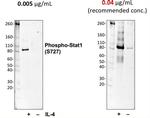 Phospho-Stat1 (Ser727) Antibody in Western Blot (WB)