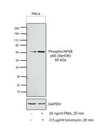 Phospho-NFKB p65 (Ser536) Antibody