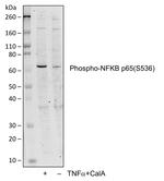 Phospho-NFKB p65 (Ser536) Antibody in Western Blot (WB)