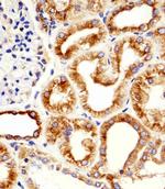 beta Tubulin Antibody in Immunohistochemistry (Paraffin) (IHC (P))