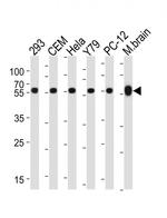 beta Tubulin Antibody in Western Blot (WB)