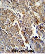 ALDH3A2 Antibody in Immunohistochemistry (Paraffin) (IHC (P))