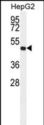 ALDH3A2 Antibody in Western Blot (WB)