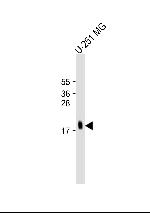 MCFD2 Antibody in Western Blot (WB)