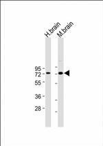 LIMK1 Antibody in Western Blot (WB)