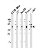 VEGFC Antibody in Western Blot (WB)