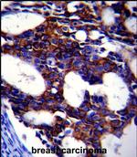 TGF beta-2 Antibody in Immunohistochemistry (Paraffin) (IHC (P))