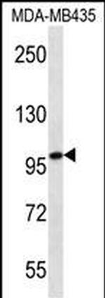 MYO1C Antibody in Western Blot (WB)