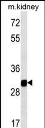 GNPDA1 Antibody in Western Blot (WB)