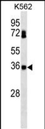 CK2 beta Antibody in Western Blot (WB)