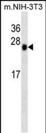 CK2 beta Antibody in Western Blot (WB)