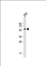 CNOT4 Antibody in Western Blot (WB)