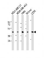 ACTA1 Antibody in Western Blot (WB)