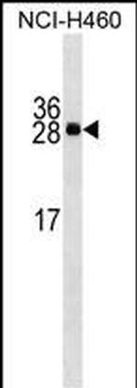 Serum Amyloid P Antibody in Western Blot (WB)