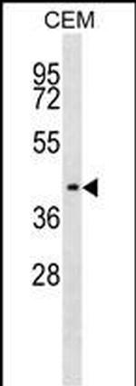 IHH Antibody in Western Blot (WB)