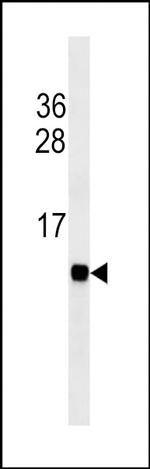 FABP3 Antibody in Western Blot (WB)