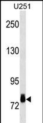 RSK2 Antibody in Western Blot (WB)