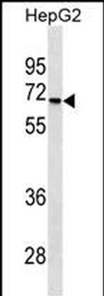 STK39 Antibody in Western Blot (WB)