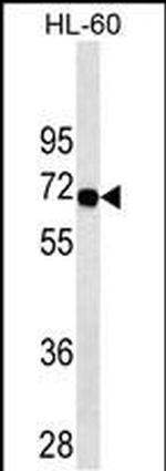 SWAP70 Antibody in Western Blot (WB)