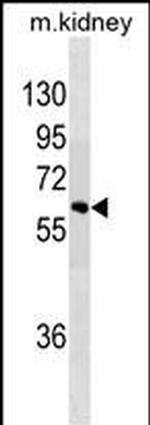 SPRED1 Antibody in Western Blot (WB)