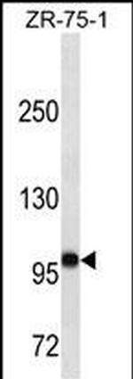 FUT4 Antibody in Western Blot (WB)