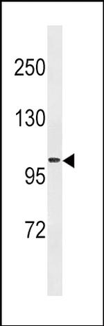 Fibrinogen alpha chain Antibody in Western Blot (WB)