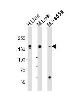 Fibrinogen alpha chain Antibody in Western Blot (WB)