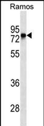 Btk Antibody in Western Blot (WB)