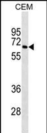 BLNK Antibody in Western Blot (WB)