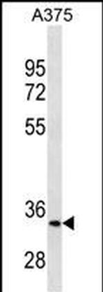 MC1R Antibody in Western Blot (WB)