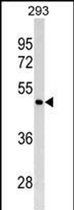 GATA4 Antibody in Western Blot (WB)