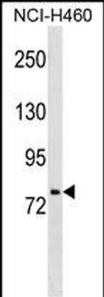 HNF1A Antibody in Western Blot (WB)