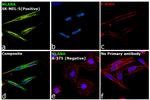 Melan-A Antibody in Immunocytochemistry (ICC/IF)