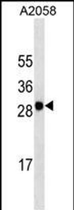 Melan-A Antibody in Western Blot (WB)