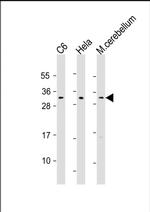 PLP1 Antibody in Western Blot (WB)