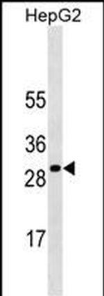 SOCS3 Antibody in Western Blot (WB)