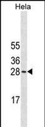 COMT Antibody in Western Blot (WB)