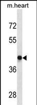 D4 Dopamine Receptor Antibody in Western Blot (WB)