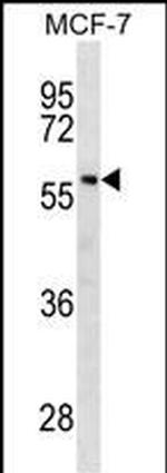 GBA Antibody in Western Blot (WB)