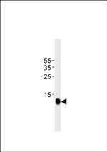 FABP3 Antibody in Western Blot (WB)